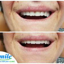 Smile Denture & Implant Clinic | 1825 Woodward Dr, Ottawa, ON K2C 0P9, Canada